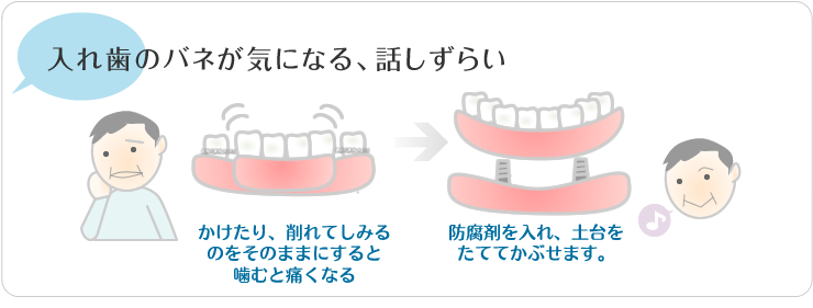 入れ歯のバネが気になる、話しづらい。かけたり、削れしみるのをそのままにすると噛むと委託なる。防腐剤を入れ、土台をたててかぶせます。