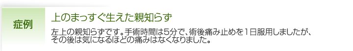 上のまっすぐ生えた親知らず |左上の親知らずです。手術時間は5分で、術後痛み止めを1日服用しましたが、 その後は気になるほどの痛みはなくなりました。