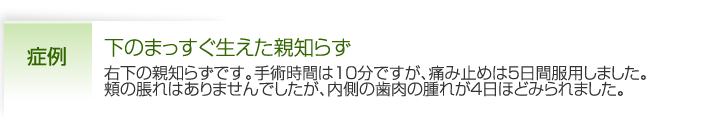 下のまっすぐ生えた親知らず |一番上にあるのが親知らずです。銀歯の辺縁から虫歯ができています。また奥の歯肉が炎症をおこして、赤く脹れています。レントゲン写真でみると、親知らずの根がふたつに分岐していることがわかります。抜いた親知らずを見ると、銀歯の辺縁だけでなく、歯の側面で歯肉の中に隠れていた部分も虫歯になっていました。